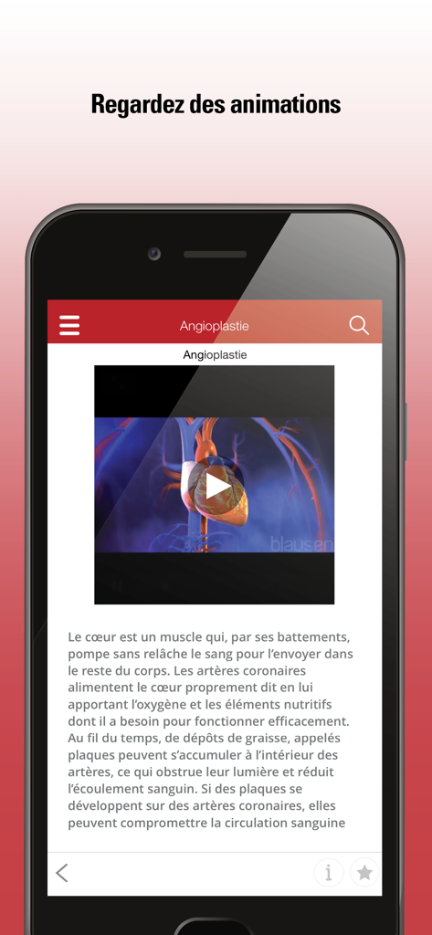 Le Manuel MSD grand public - Capture d'écran de l'application française Manuel MSD montrant une animation médicale sur l'angioplastie et le cœur.