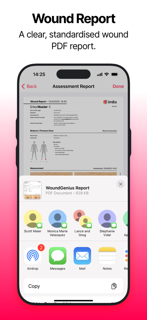 A smartphone screen showing a professional PDF wound report from the WoundGenius app being shared via a standard iOS share menu