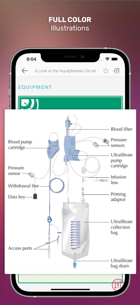A detailed color diagram of an aquapheresis circuit showing labeled medical equipment components in the Lippincott Nursing Procedures app.
