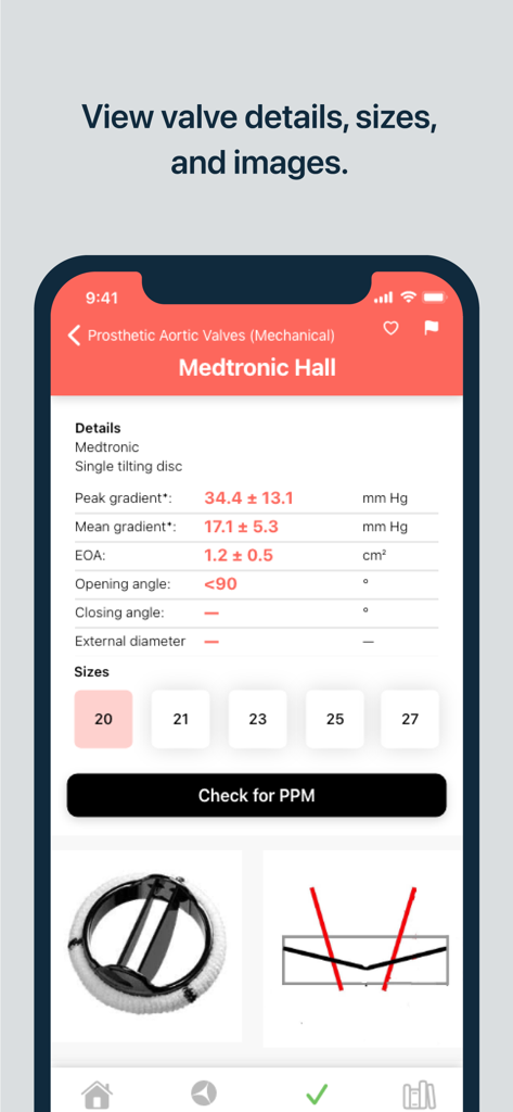 Valve PPM - Medical App | MWM
