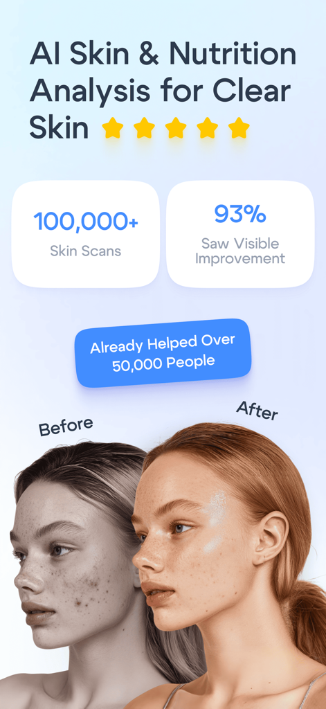 Before and after skin comparison showing visible improvement with statistics from the Lumé AI Skin Scanner app