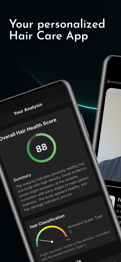 Hair Guru - AI Scalp/Hair Scan - A mobile app screen displaying an overall hair health score of 88 and a detailed hair classification report based on the Norwood Scale