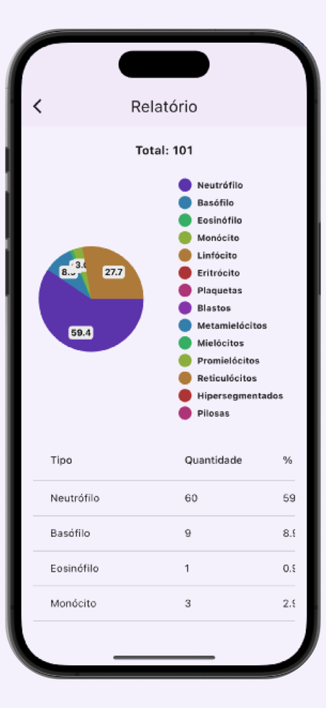 Leucogram | wbc counter - Una pantalla de informe de la aplicación Leucogram que muestra un gráfico circular y una tabla que detallan los recuentos y porcentajes de glóbulos blancos.