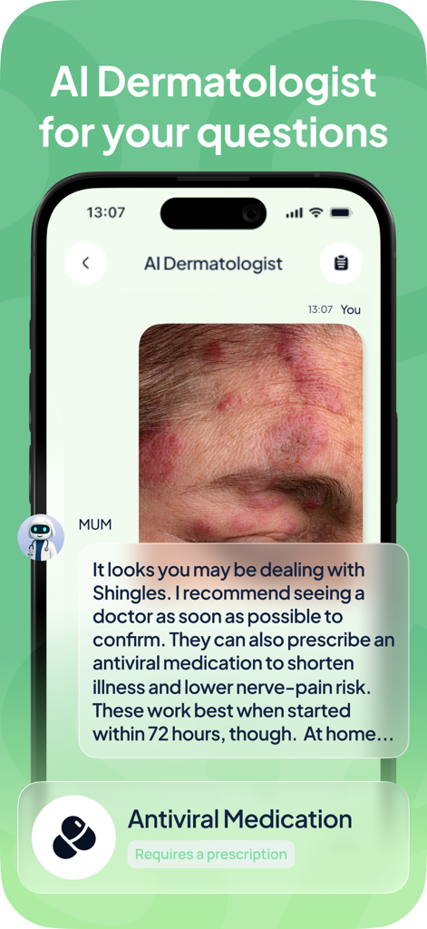 Mobile screen of Rash ID app showing AI dermatologist MUM identifying a skin rash as Shingles and providing medical advice