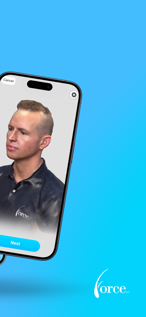 Application Force HT Pro affichant un modèle 3D détaillé de la tête pour une consultation de greffe de cheveux