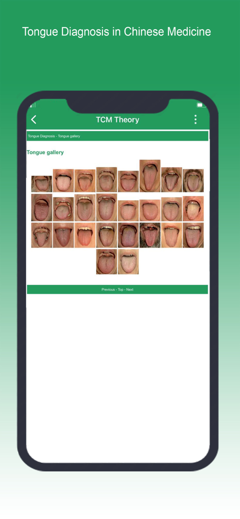 Shen-Acupuncture - Shen-Acupunctureアプリで伝統中国医学理論の舌診ギャラリーを表示。