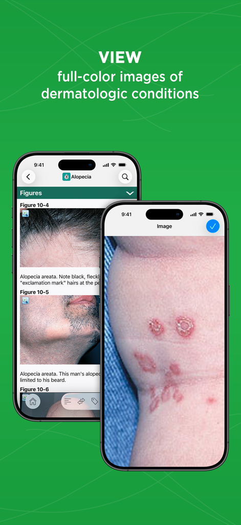 5 Minute Clinical Consult - Imágenes a todo color de afecciones dermatológicas dentro de la aplicación móvil 5 Minute Clinical Consult.