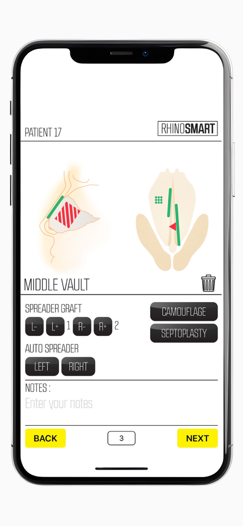Rhino Smart - Digital surgical procedure sheet in the Rhino Smart app displaying rhinoplasty anatomical diagrams and clinical data fields