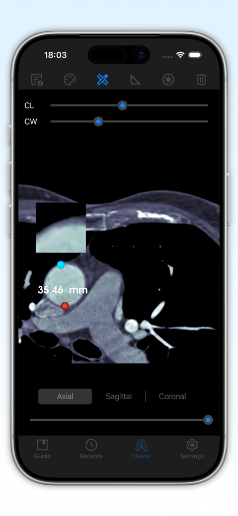 DICOM Studio Go - DICOM Studio Go app displaying a CT scan with a 35.46 mm measurement on an iPhone