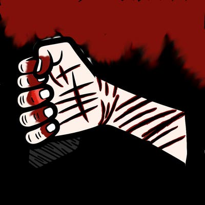 an arm with scratch marks