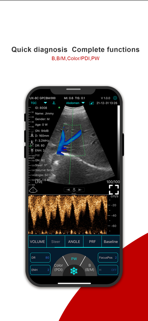MY USG - Interfaz de aplicación móvil para MY USG mostrando un escaneo de ultrasonido portátil con controles de diagnóstico médico