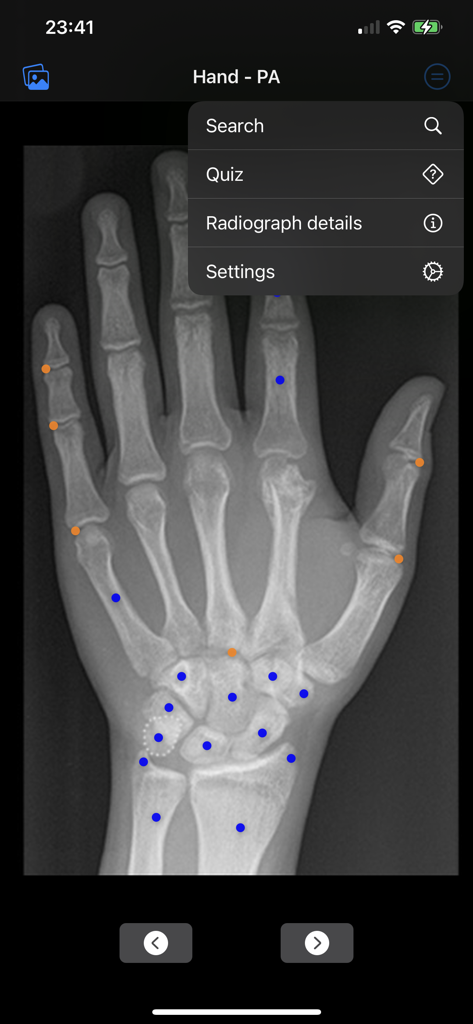 X-ray of a hand showing anatomical landmark markers and navigation menu in the Xray Anatomy app.