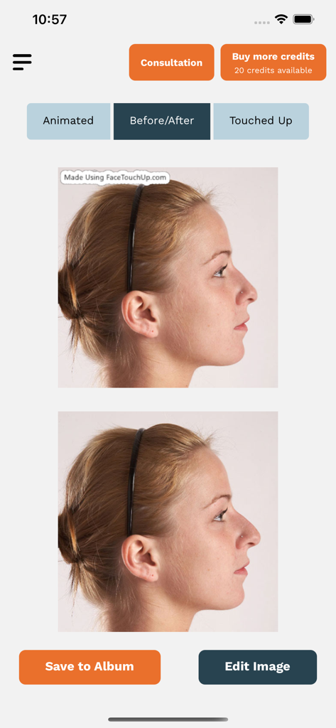 FaceTouchUp Nose Job Simulator - アプリ内の鼻整形シミュレーションのビフォー・アフター結果。