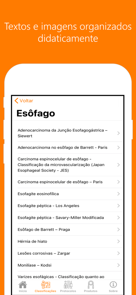 Classificações Endoscópicas - モバイルアプリのインターフェースに、Los Angeles、Paris、Siewertのカテゴリを含む食道内視鏡分類のリストが表示されています。