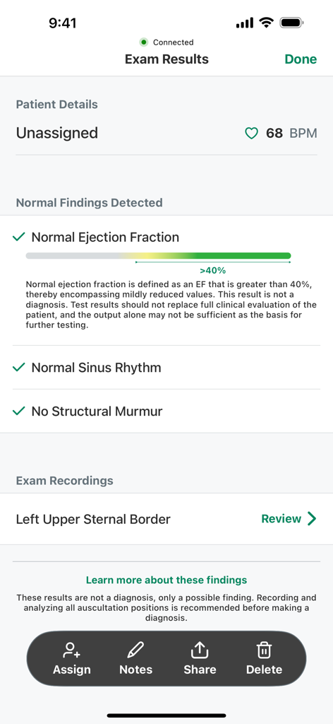 SENSORA™ by Eko Health - Aplicativo SENSORA by Eko Health exibindo resultados normais de exame cardíaco, incluindo fração de ejeção, ritmo sinusal e ausência de sopro estrutural