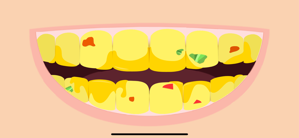 Daily Tasks - Ilustración caricaturizada de una boca con dientes amarillos sucios y partículas de comida