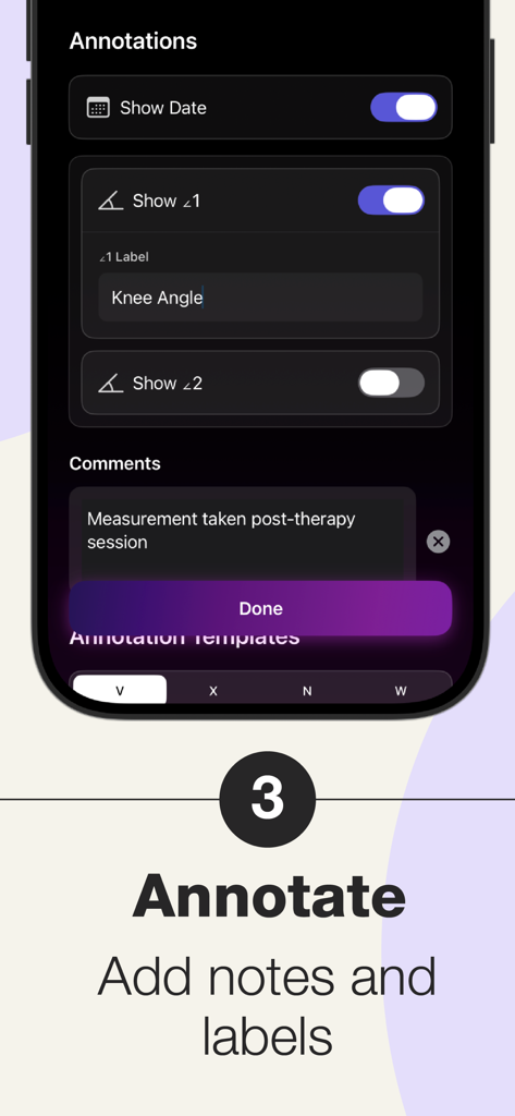 Angulus Pro - Precision Angle - Interface mostrando ferramentas de anotação e rotulagem no aplicativo Angulus Pro para medições de ângulos clínicos