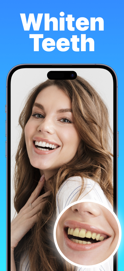 Schermata dello smartphone che mostra un confronto prima e dopo lo sbiancamento dei denti di una donna sorridente