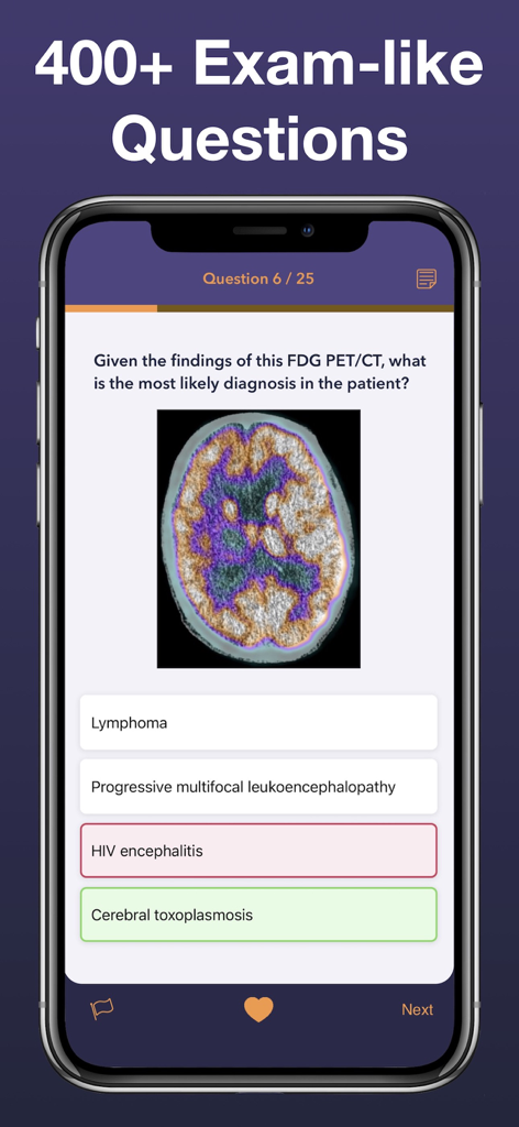 A medical resident using the Radiology Board Review app to answer a multiple choice question based on a brain scan image.