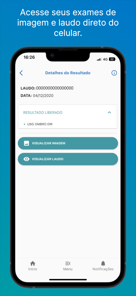 Portal do Paciente HC app interface showing medical exam results with buttons to view imaging and reports.