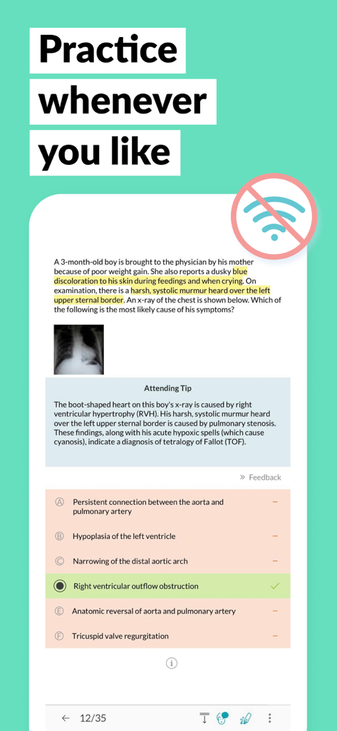 AMBOSS Qbank for Medical Exams - Pregunta de práctica de examen médico en el Qbank de AMBOSS que muestra el modo sin conexión y las funciones de Attending Tip
