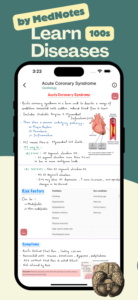 MedDose Pro - MCQs & Diseases - Clinical notes about Acute Coronary Syndrome pathology and symptoms in the MedDose Pro app