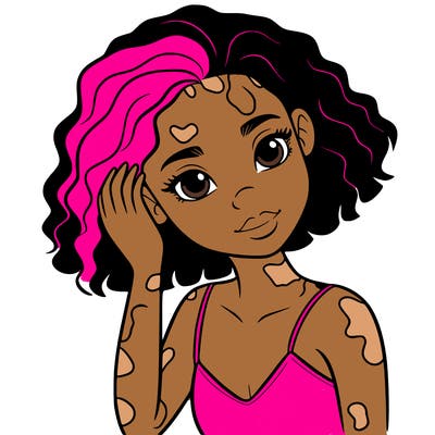 vitiligo black girl