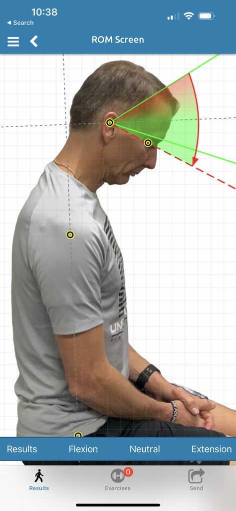Cervical range of motion assessment using PostureScreen Mobile AI to measure neck flexion