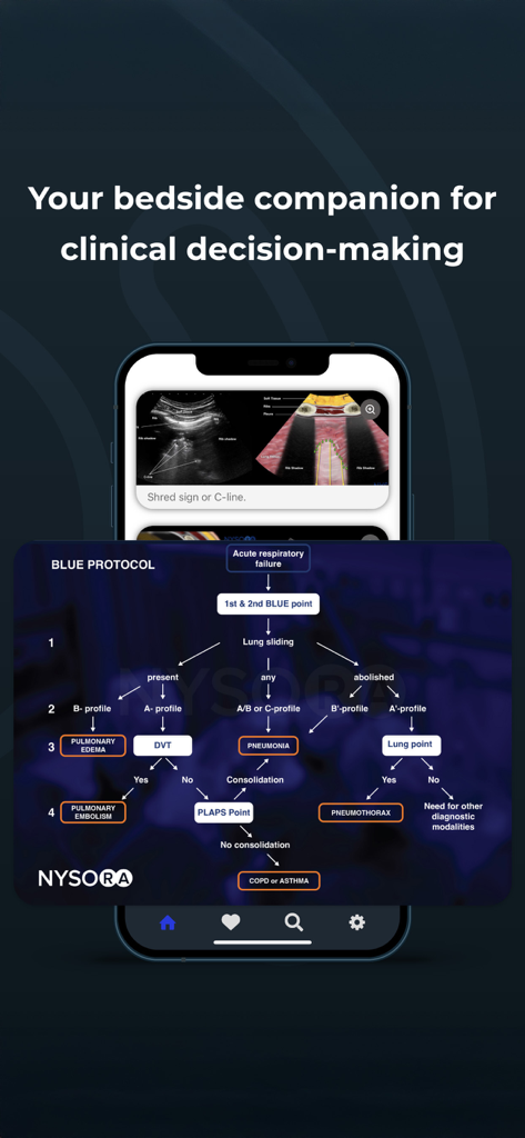 Point of Care Ultrasound - Aplicativo NYSORA POCUS exibindo o fluxograma do protocolo BLUE para tomada de decisão clínica à beira do leito
