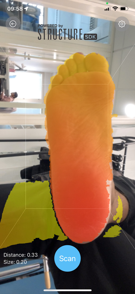 SoleScan 3D - SoleScan 3D app interface showing a digital 3D foot scan for medical orthotics.