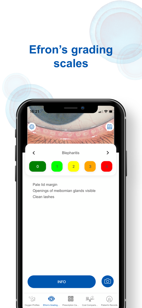 OptiExpert™ - OptiExpert App zeigt die Efron-Skala für Blepharitis-Augenerkrankung an