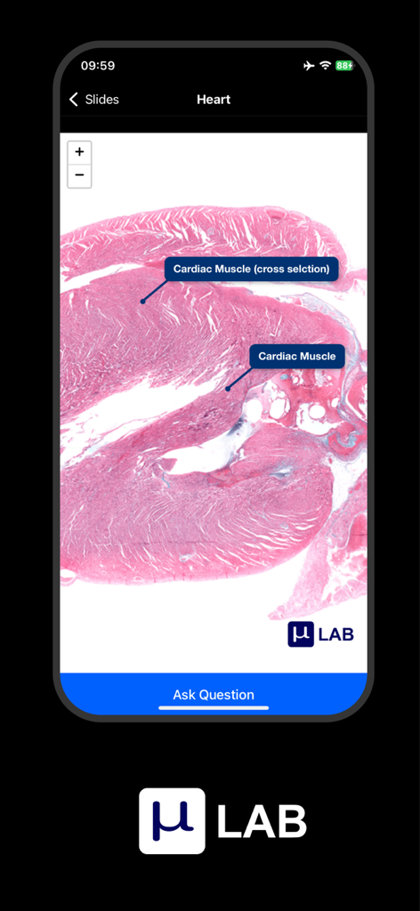 A histology slide of heart tissue showing annotated cardiac muscle structures in the Microlab app.