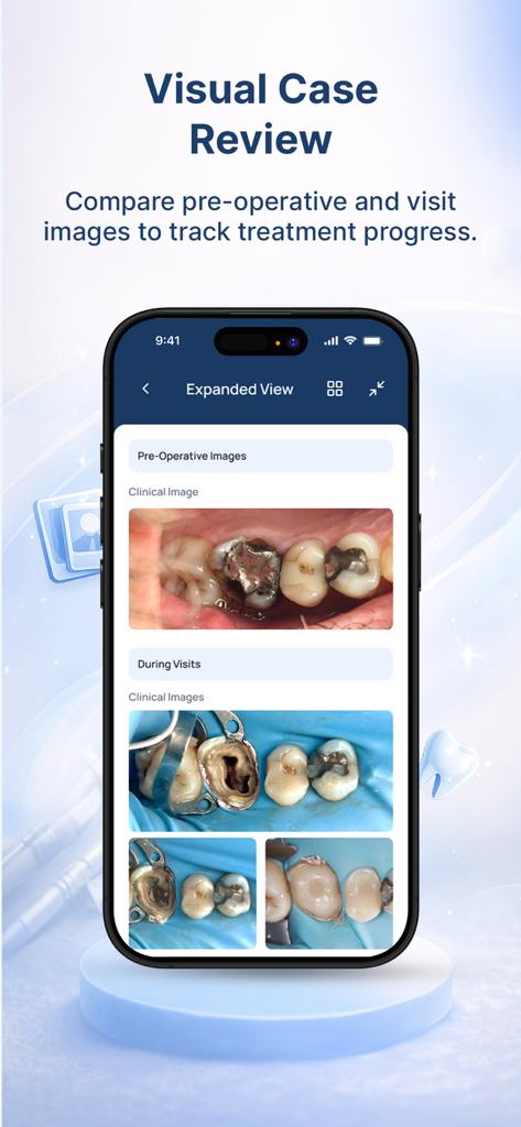 Interfaz de la aplicación UpDent que muestra la revisión visual de casos con imágenes dentales preoperatorias y de visita para seguir el progreso del tratamiento.