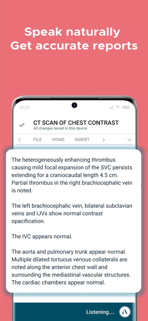 Augnito medical dictation app showing a chest scan report generated with voice AI