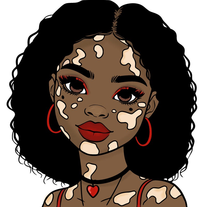 bleautiful black girl with vitiligo