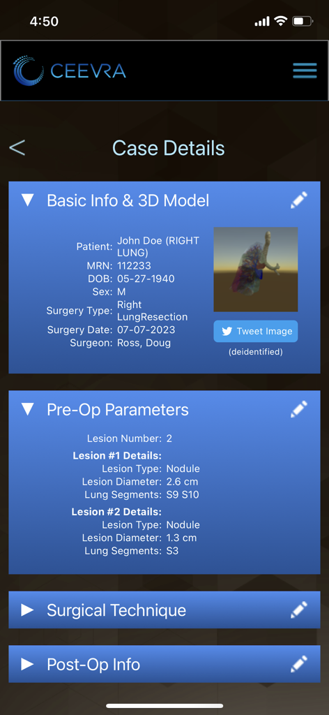 Ceevra - Ceevra app interface showing surgical case details and a 3D anatomical model for preoperative planning