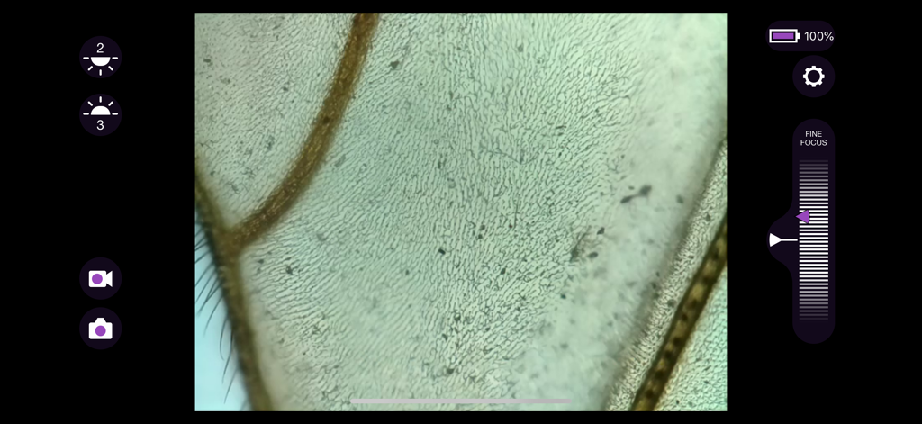 ioLight Microscope app showing a high resolution microscopic image with focus and capture controls