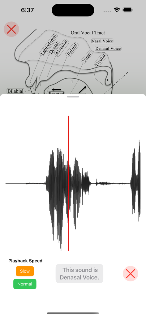 iPA Phonetics - Schéma anatomique du conduit vocal oral et forme d'onde sonore pour l'analyse de la voix dénasale.