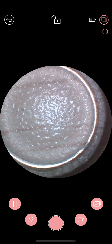 iTiMO - A magnified view of skin texture inside the iTiMO app interface