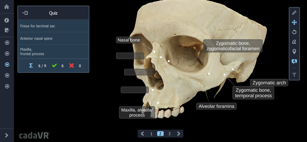 Interactive quiz screen in the cadaVR anatomy app showing a labeled 3D human skull model