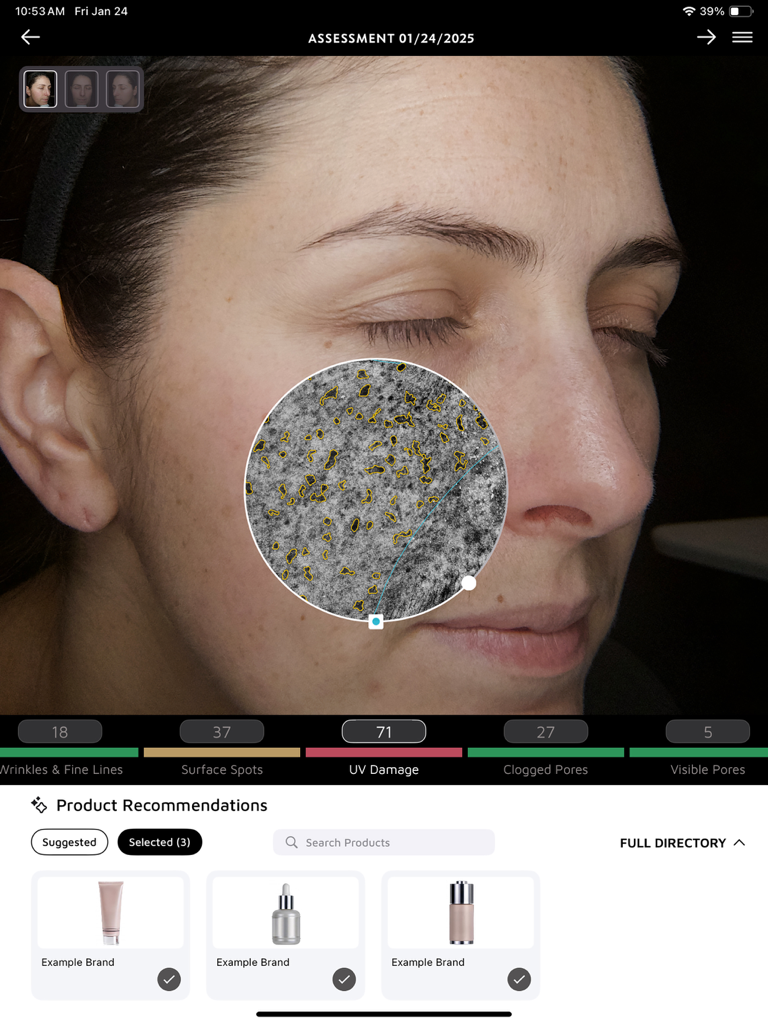 Professional skin assessment interface in the NEXA app showing UV damage visualization and recommended skincare products