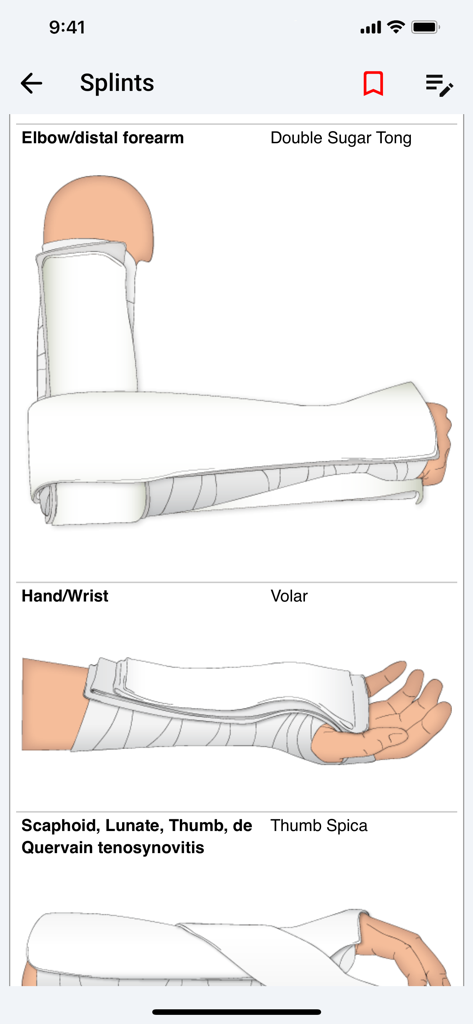 palmEM AI: EM Quick Reference - Medical illustrations of splinting techniques including Double Sugar Tong and Volar splints within the palmEM AI app interface.