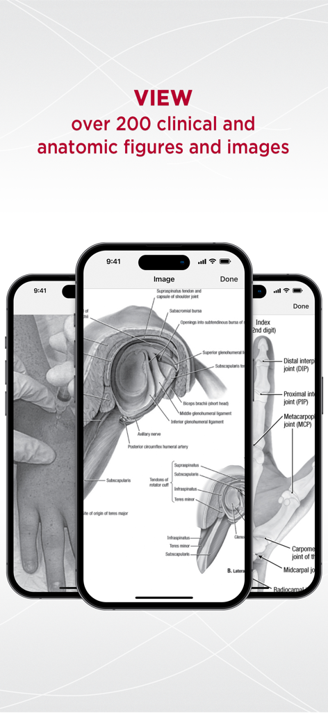 Três telas de smartphone exibindo diagramas anatômicos e clínicos detalhados dentro do aplicativo 5 Minute Sports Med Consult