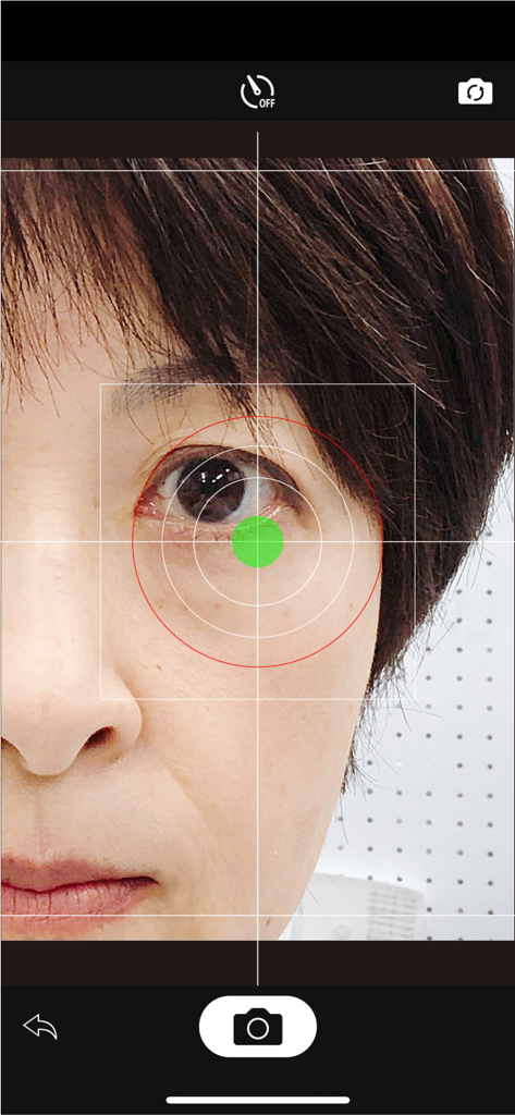 Eyelid - Clinical camera interface of the Eyelid app showing an alignment grid and spirit level over a patient's eye.