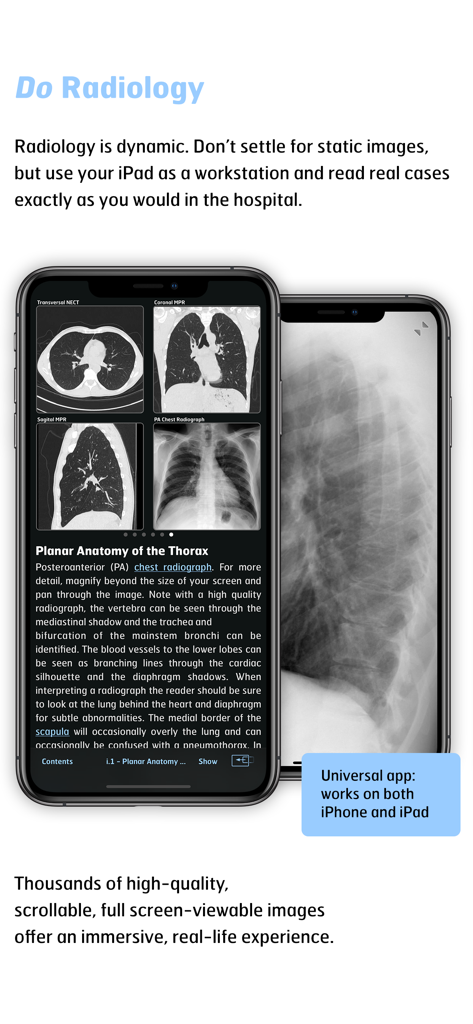 胸部の画像診断 Thoracic Imaging 困ったときの胸部の画像診断 (画像診断別冊KEY BOOKシリーズ) | 芦澤和
