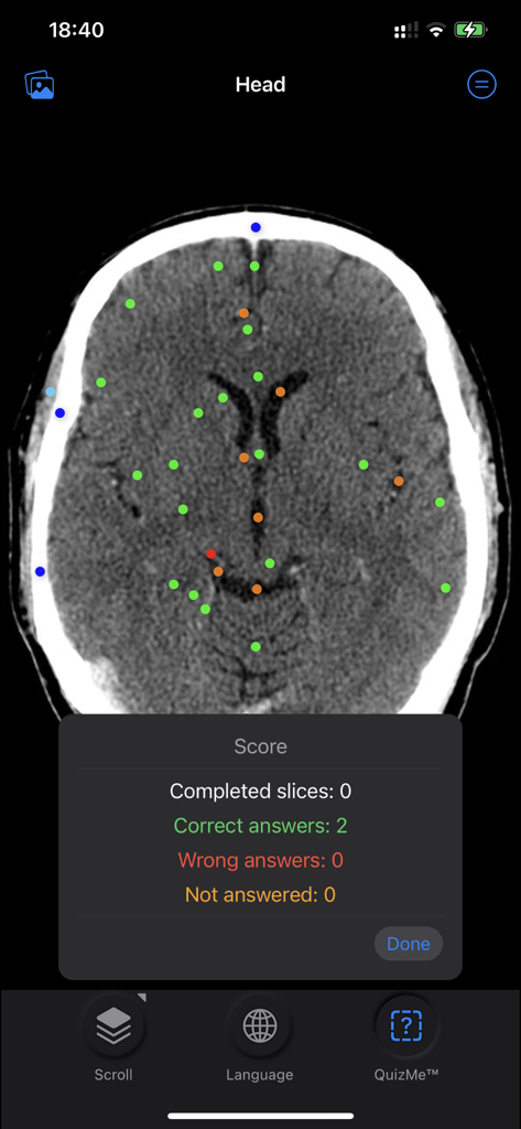 CT Anatomy app QuizMe mode displaying a brain scan with anatomical pins and a score summary