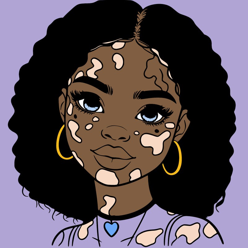 bleautiful black girl with vitiligo