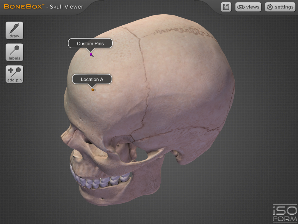 Detailed 3D human skull model with anatomical labels and interactive pins in BoneBox app interface