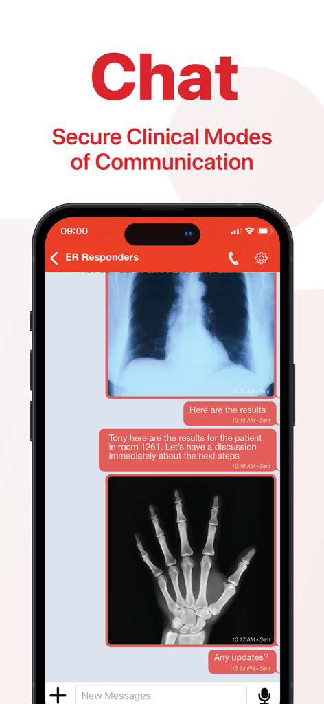 Deltapath Acute - Sichere klinische Chat-Oberfläche in der Deltapath Acute App zeigt gemeinsam genutzte Röntgenbilder und Nachrichten zwischen medizinischem Personal an
