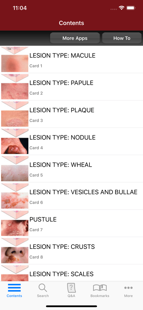 Fitzpatrick's Derm Flash Cards - Inhaltsverzeichnis in der Fitzpatrick's Dermatology Flash Cards App mit verschiedenen Läsionstypen wie Makel, Papel und Plaque mit klinischen Bildern